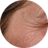 Fine Lines<br />
and<br />
Wrinkles